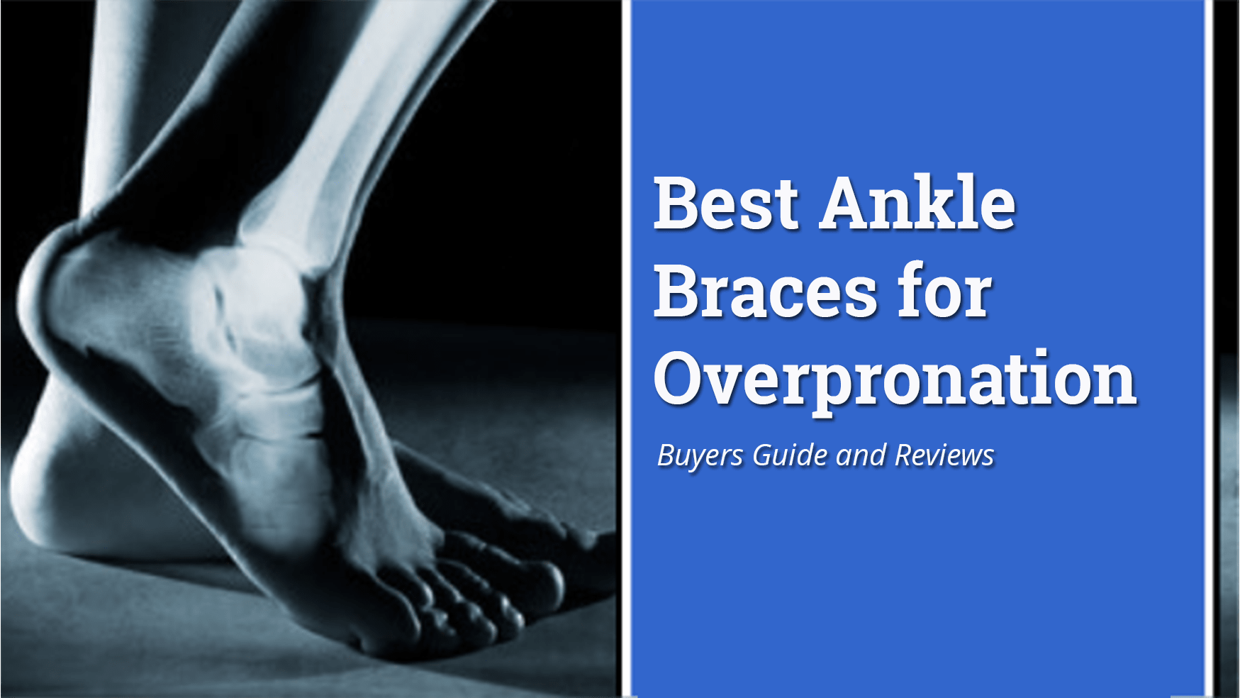 Best Ankle Brace for Overpronation 