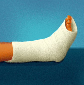 Broken Foot ankle injuries